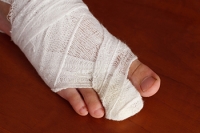 Medical Intervention for a Broken Toe