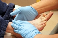 Diabetic Foot Problems and Quality of Life