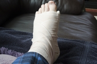 Diagnosing and Managing Foot Fractures